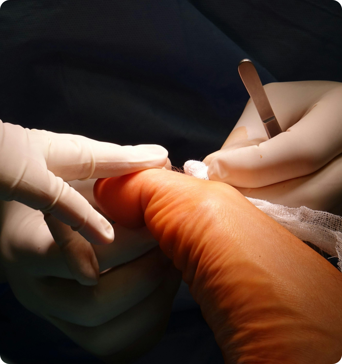 Surgical Podiatry procedure